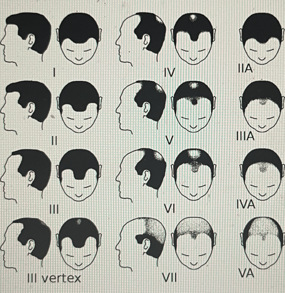 Male Senescence Phenotypes Include Hair Loss and Hair Gain