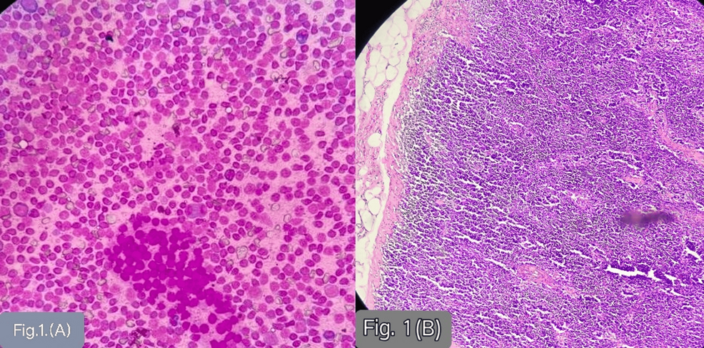 Evaluating the Sydney System for Tuberculosis Diagnosis in Endemic Areas - News Directory 3