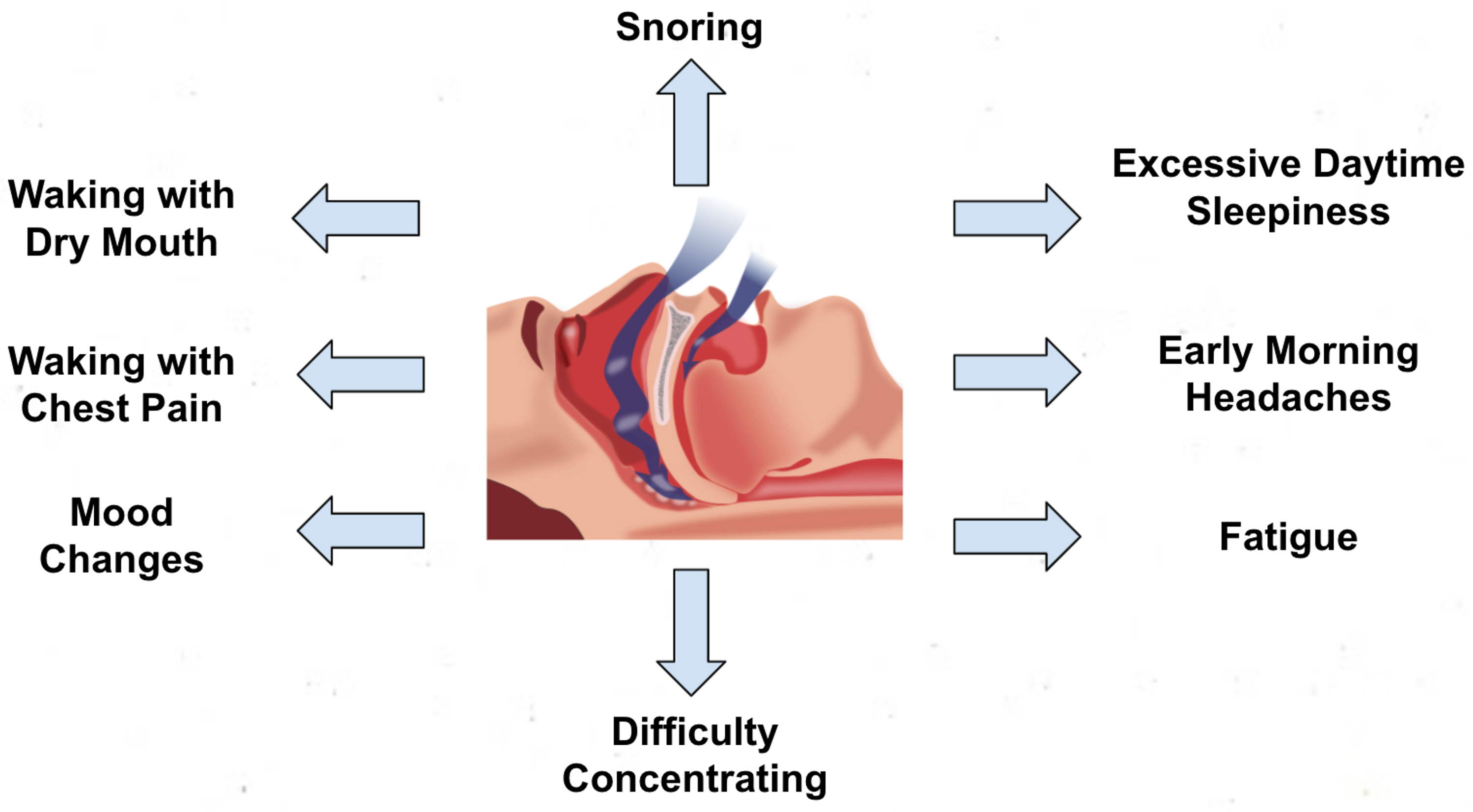 upper chest discomfort abd cpap