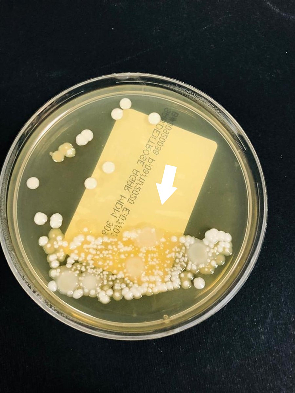 Candida-auris-colonies-growing-on-Saboraux-dextrose-agar