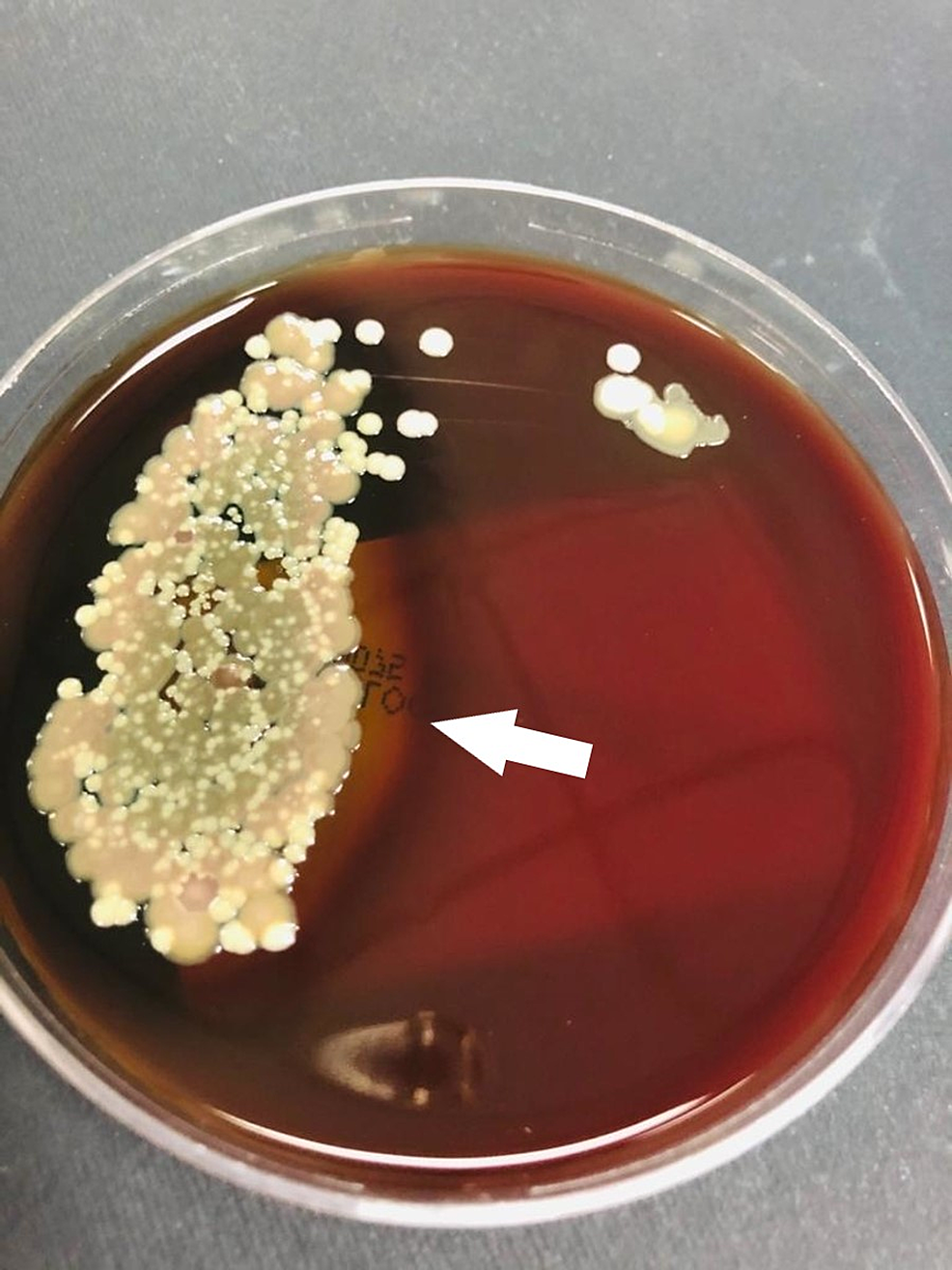 Candida-auris-colonies-growing-in-sheep-blood-agar