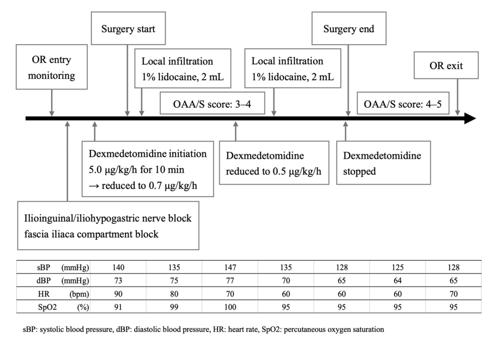Perioperative-timeline-of-multimodal-anesthesia.