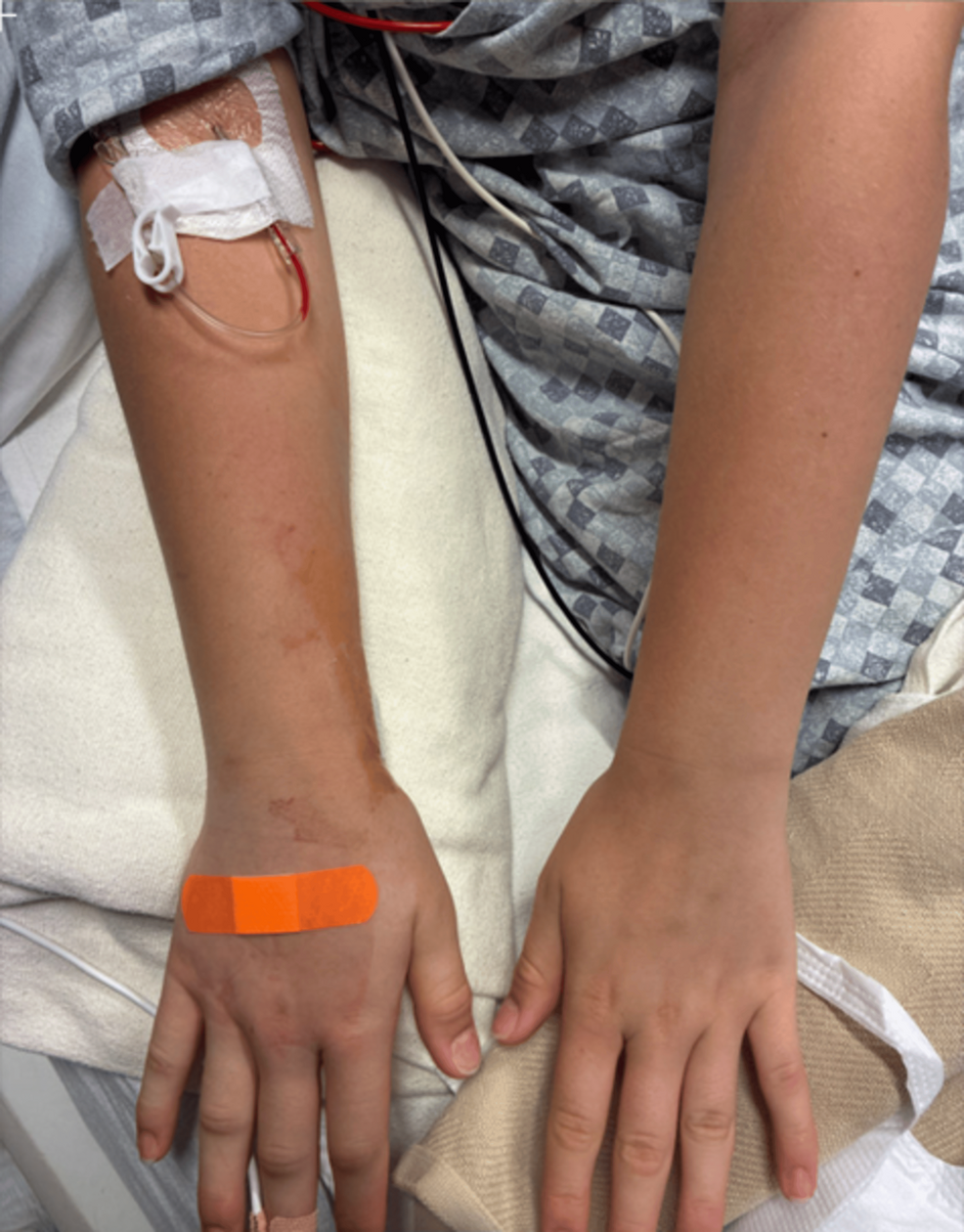 Right-hand-and-arm-swelling.