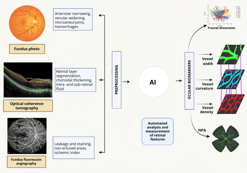 Artificial Intelligence in Predicting Systemic Complications From Retinal Findings: A New Frontier in Precision Medicine