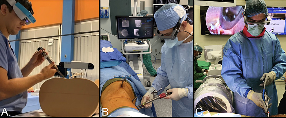 (A)-Exploring-augmented-reality-with-instrument-tracking-in-the-lab-(B)-utilizing-heads-up-display-as-an-adjunct-to-navigated-lateral-pedicle-screw-placement-and-endoscopic-diskectomy-(C).
