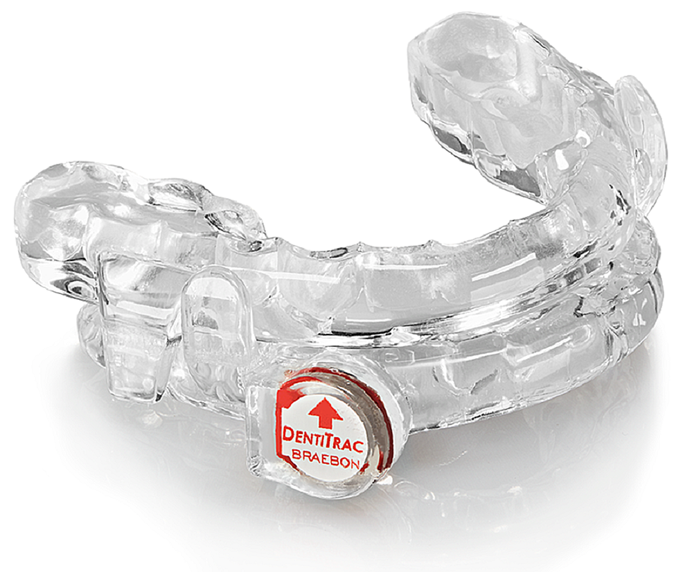 Prosomnus-[IA]-mandibular-advancement-device-with-BRAEBON-DentiTrac
