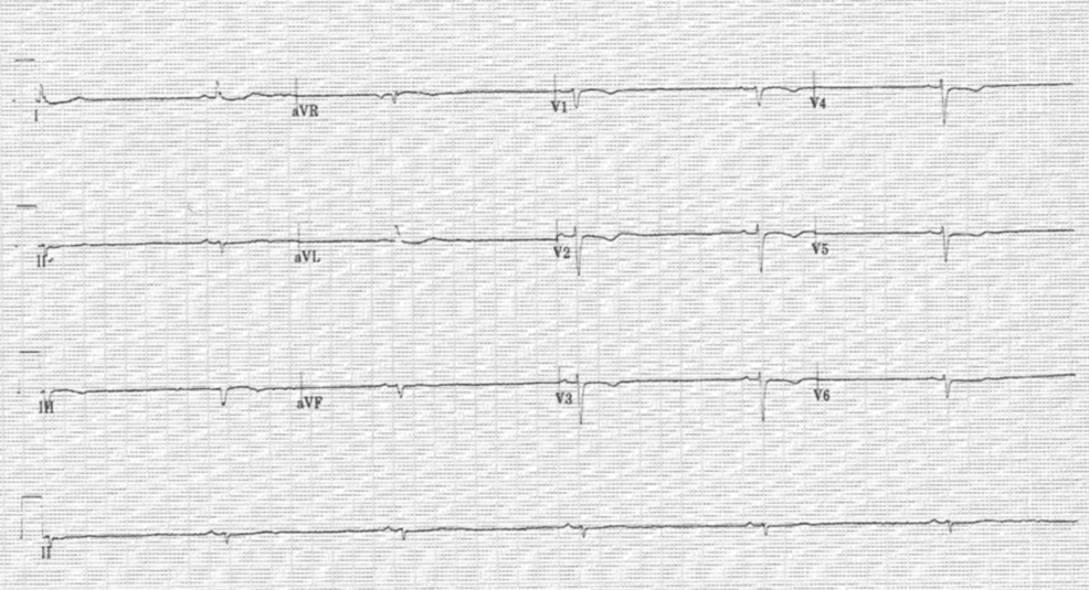 l carnitine seizures reddit Sodium Valproate-Induced Encephalopathy: A Case Report Glutathione transporter as a Sunless Tanning Oil Color:black