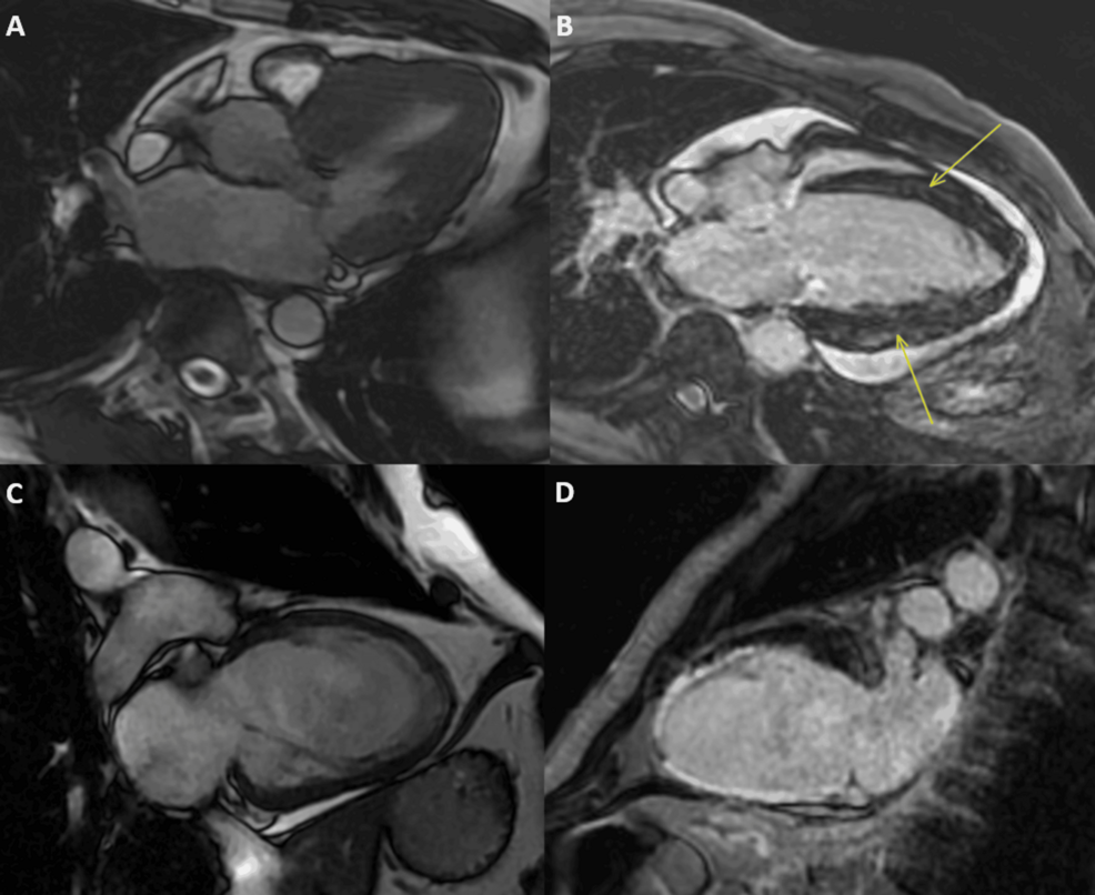 Clinical Indications and Utilisation Patterns of Cardiac MRI in a Rural Hospital - News Directory 3