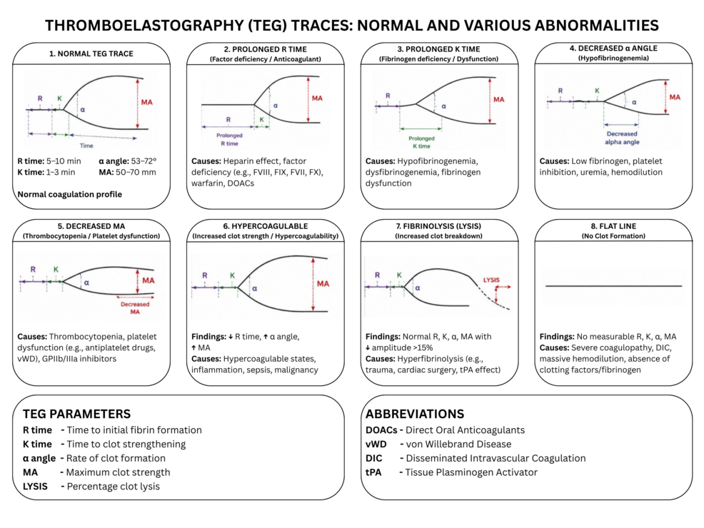 Schematic-diagram-of-thromboelastography-showing-normal-trace-and-various-abnormalities