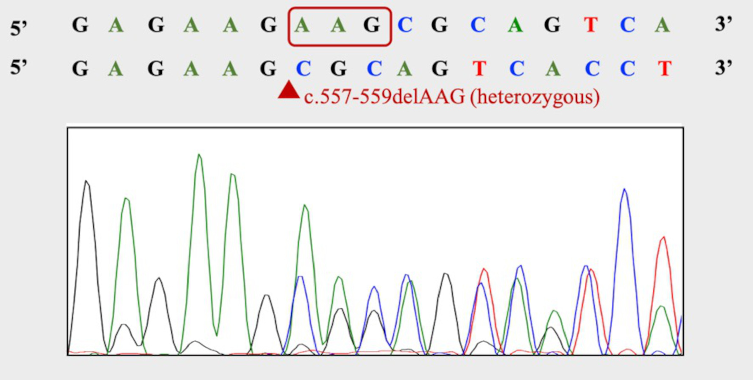 A Case of Treatment With Dabigatran for Cerebral Venous Thrombosis