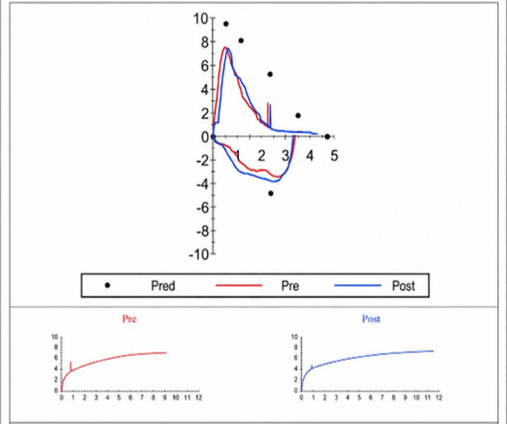 Preoperative-spirometry-demonstrating-a-predominantly-restrictive-ventilatory-pattern