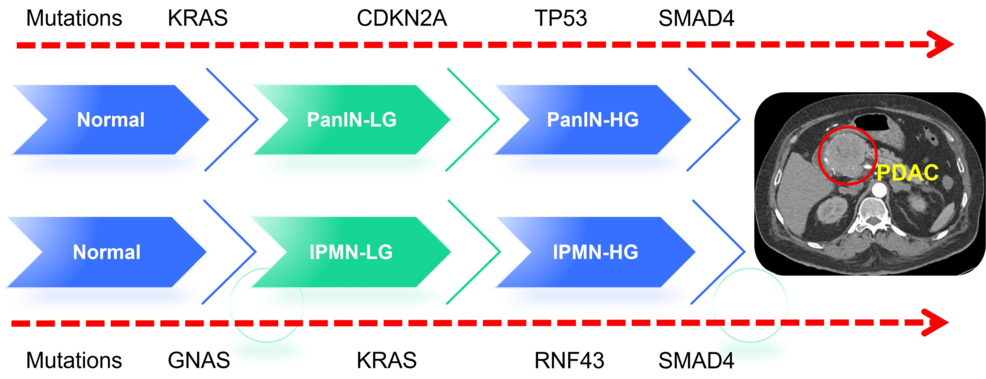 Advancements in KRAS Inhibitors for Pancreatic Cancer Treatment