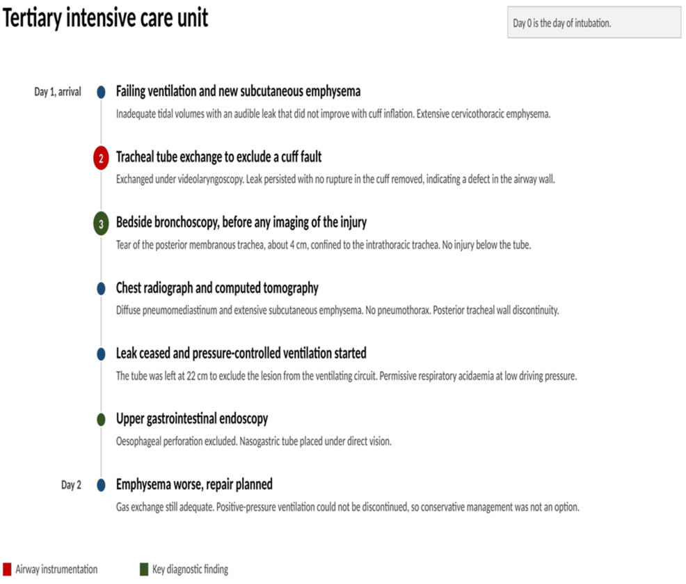 Tertiary-intensive-care-unit-timeline