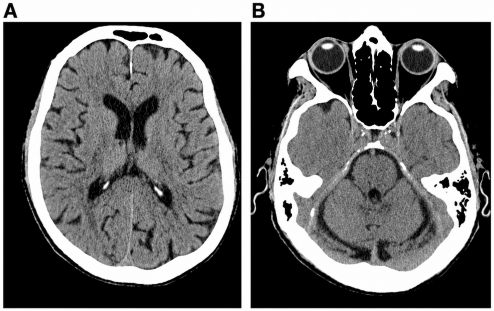 Representative-Noncontrast-Head-Computed-Tomography-Images