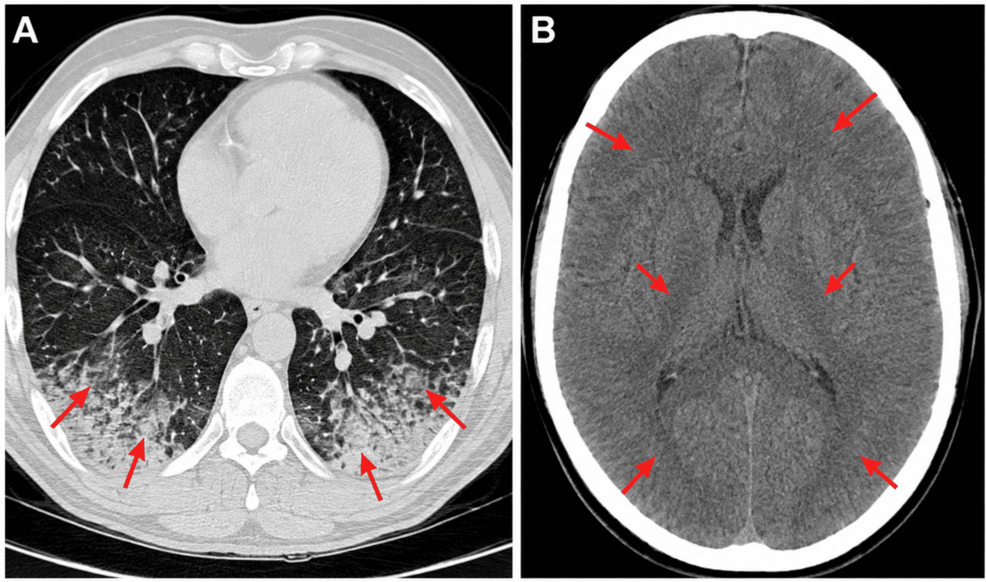 Thoracic-and-cranial-CT Thoracic-and-cranial-CT