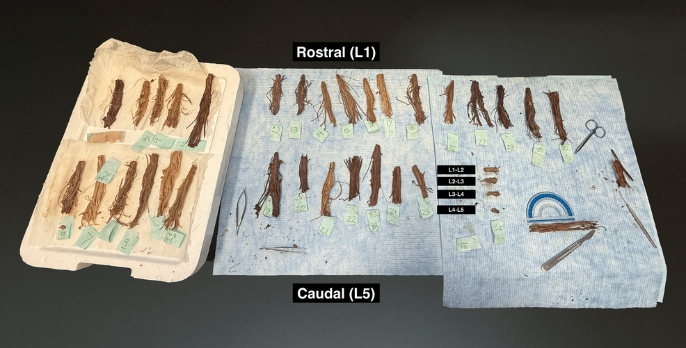 Segmental Variation in Lumbar Nerve Root Weight: A Donor-Body Study