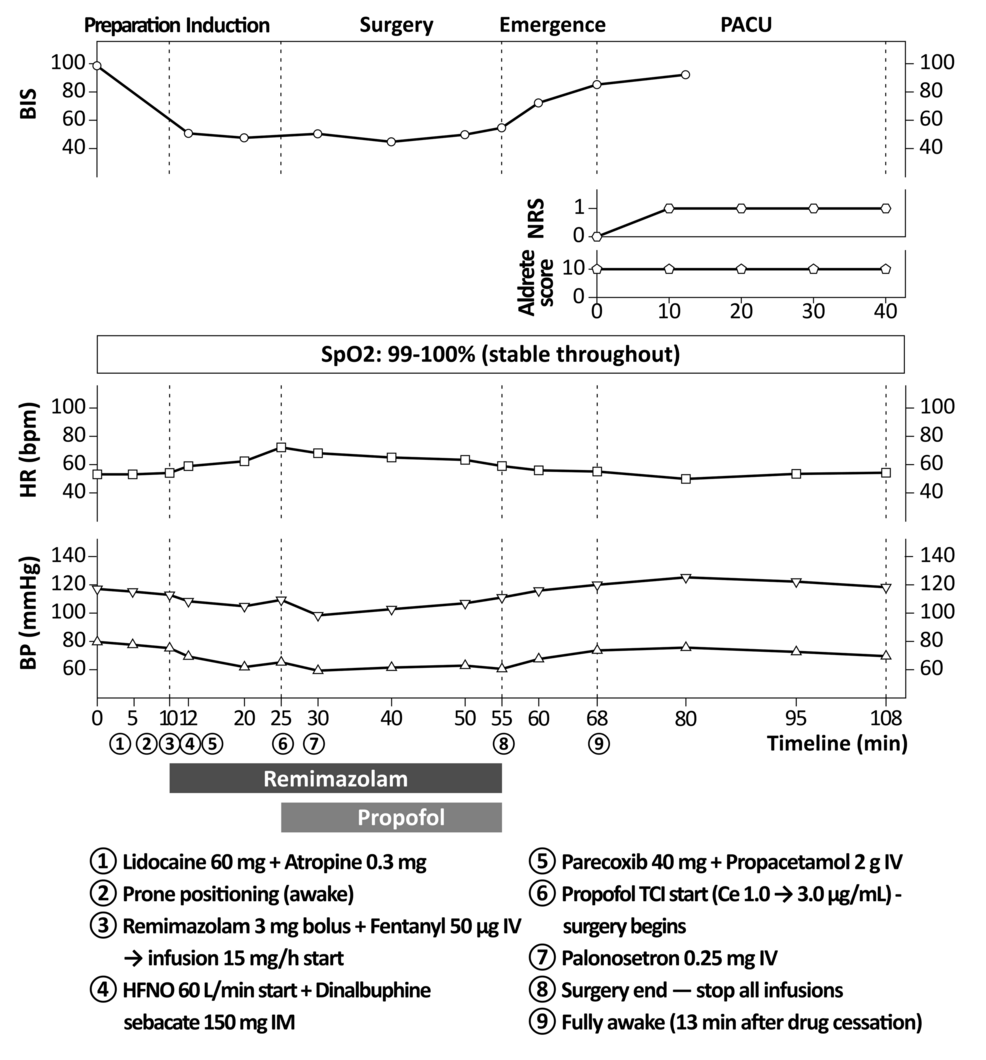 Perioperative-anesthetic-course-and-recovery.-Bispectral-index,-heart-rate,-blood-pressure,-oxygen-saturation,-anesthetic-infusions,-and-recovery-scores-are-shown-against-elapsed-time.-Both-infusions-were-stopped-at-55-min,-and-the-patient-was-fully-awake-13-min-later.-Pain-numerical-rating-scale-scores-were-0–1,-and-Aldrete-scores-were-10-during-postanesthesia-care.-