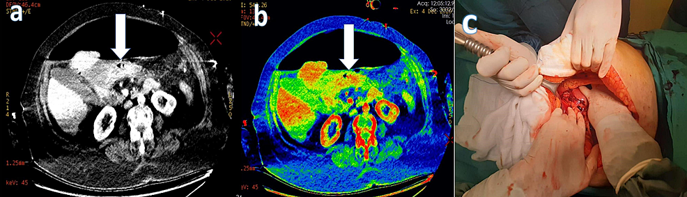 AO Scan: The Revolutionary Early Detection System of Disease Using