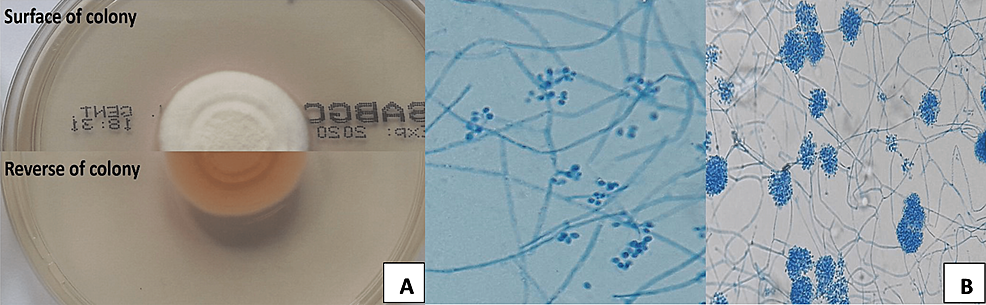 Macroscopic-(A)-and-microscopic-(B)-morphologies-of-Beauveria-bassiana-isolated-from-the-scraped-cornea-after-eight-days-of-incubation-at-30°C.-(Lactophenol-cotton-blue-staining-of-slide-culture,-original-magnification-400x.)