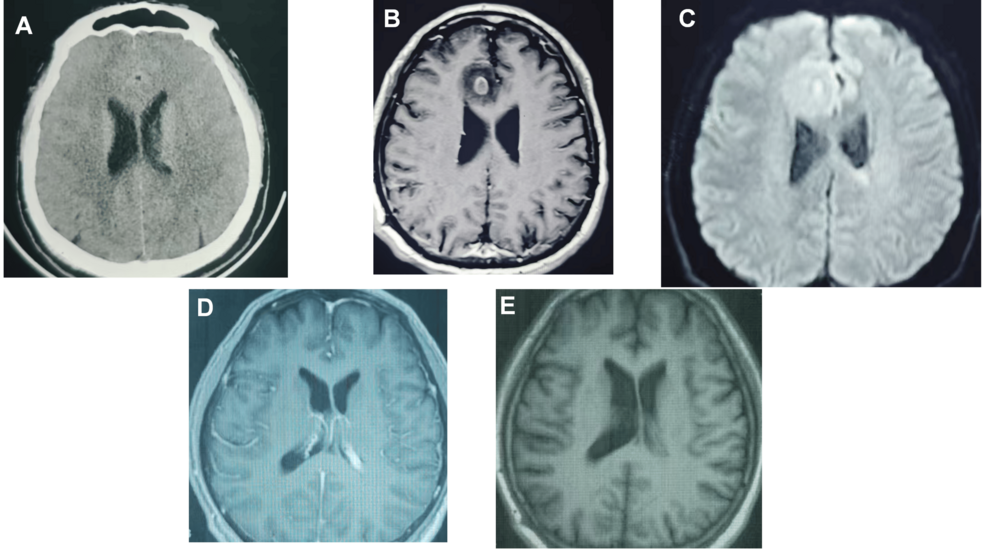Serial-cranial-imaging-during-the-clinical-course