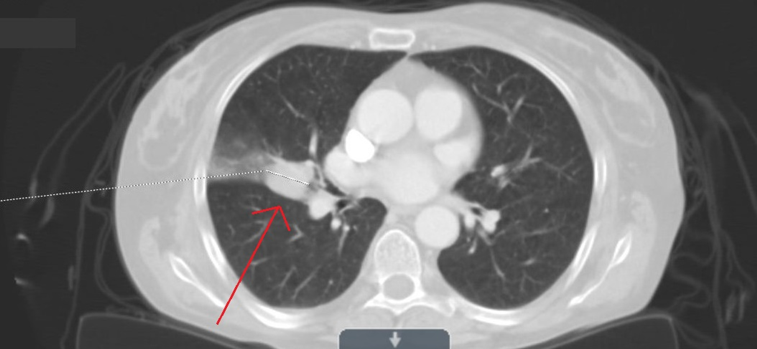 How To Tell If You Have Asbestos Cement Pipes