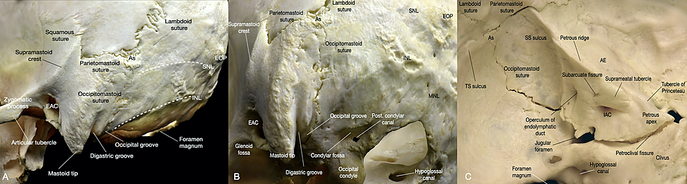 Cureus Immersive Surgical Anatomy Of The Craniometric 3496