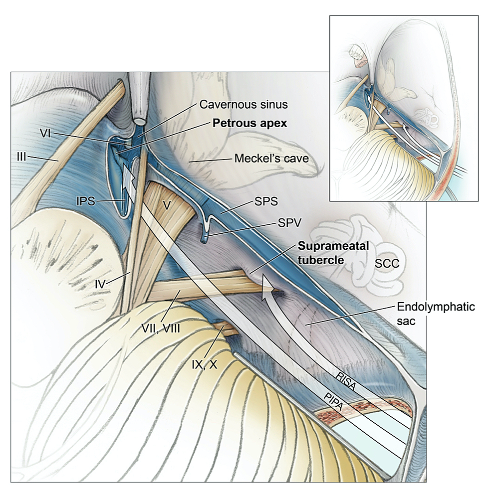 Cureus Immersive Surgical Anatomy Of The Craniometric 8601