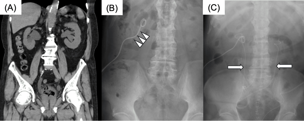 Preoperative-imaging