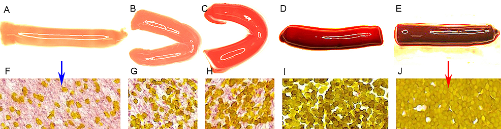 Clot analogues showing that the composition of the clot material and
