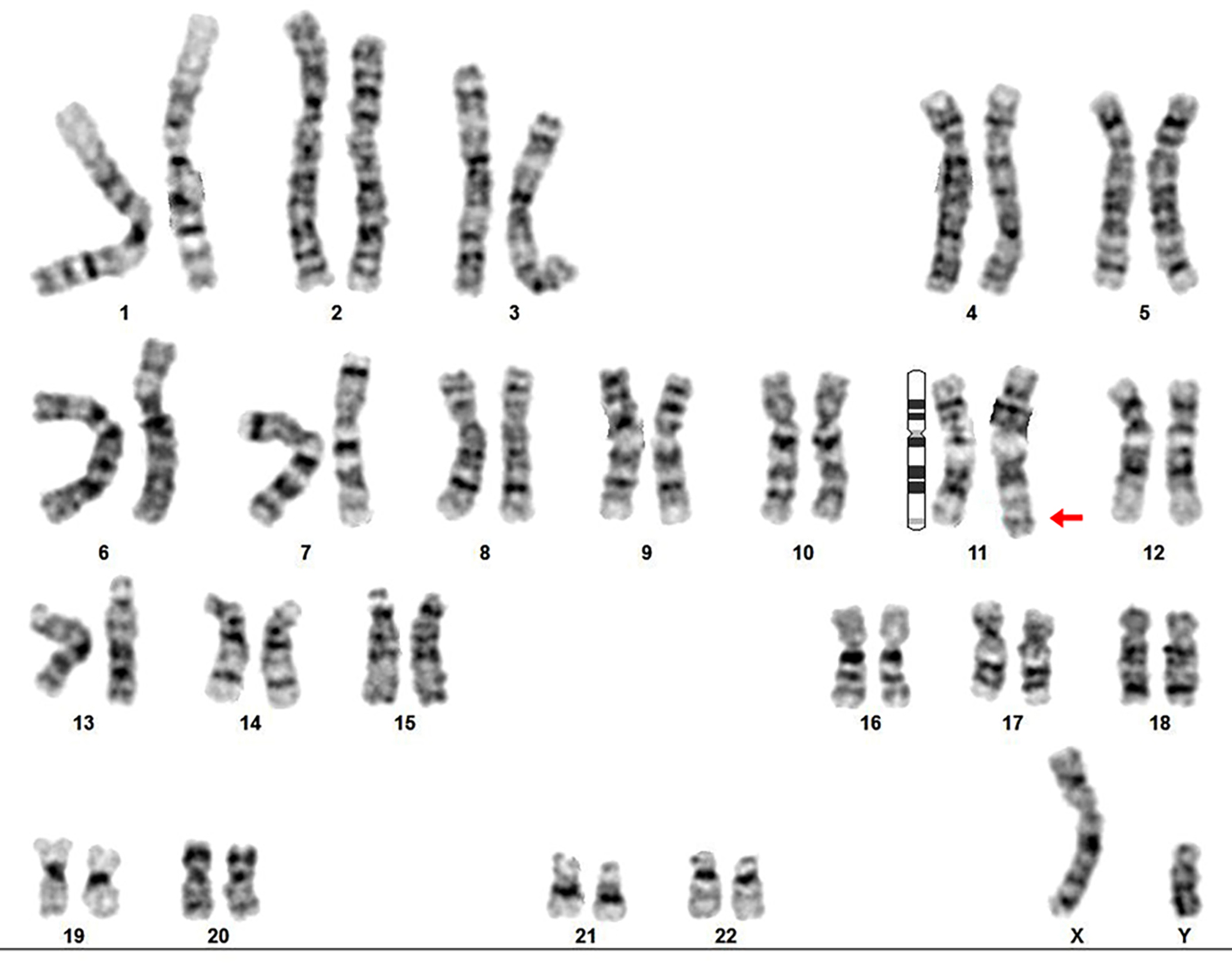 Cureus | Identification of Balanced and Unbalanced Complex Chromosomal ...