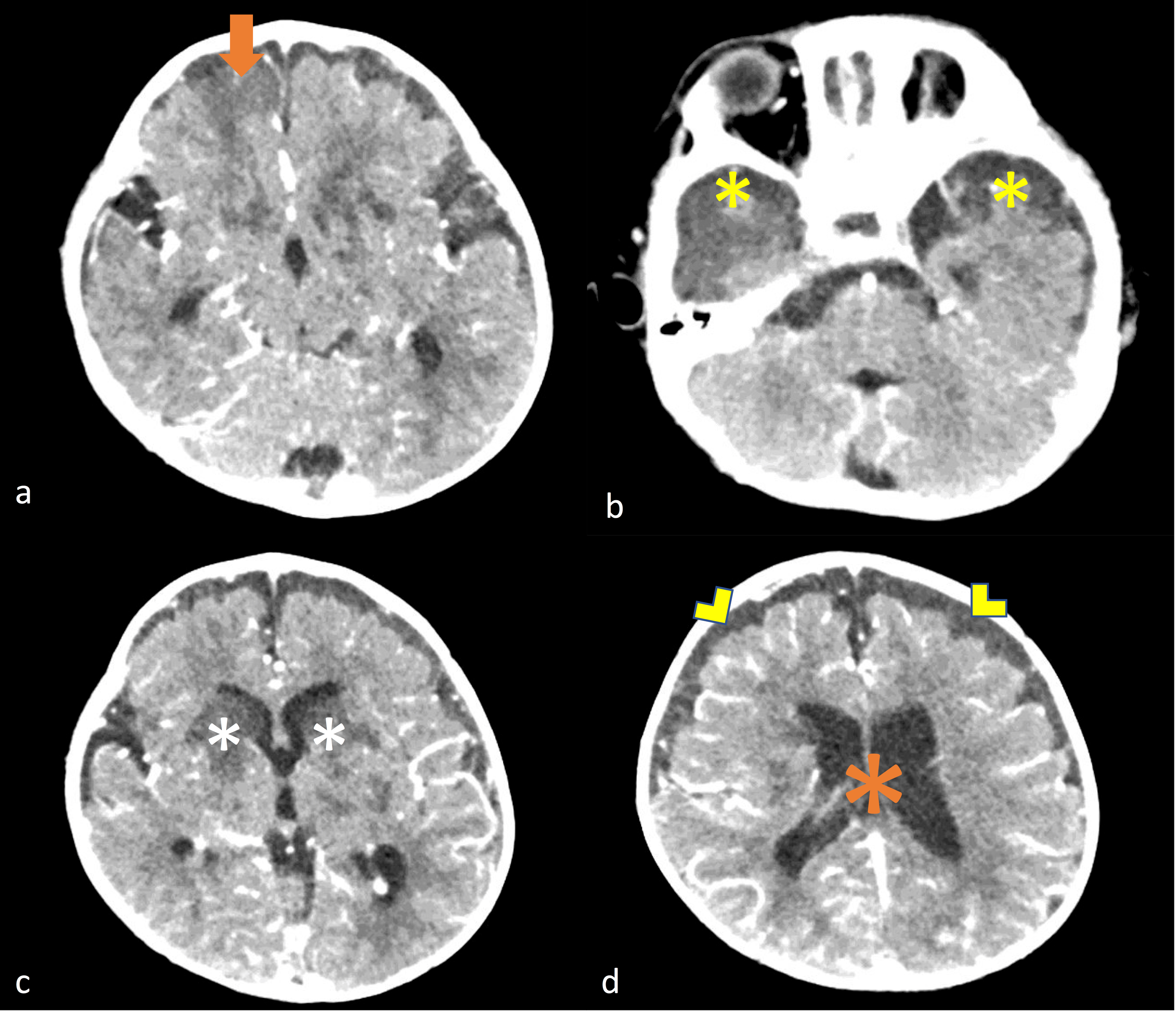 ○ clinical neuroanatomy made ridiculously simple ○ clinical neuroanatomy made ridiculously simple