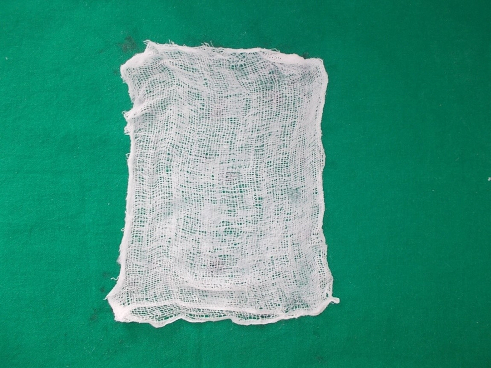 Cureus Evaluation of Banana Leaves (Musa paradisiaca) as an