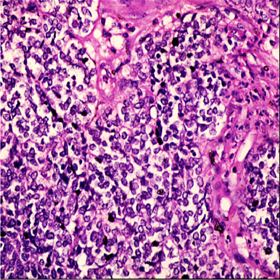 how long does mesothelioma lawsuit take