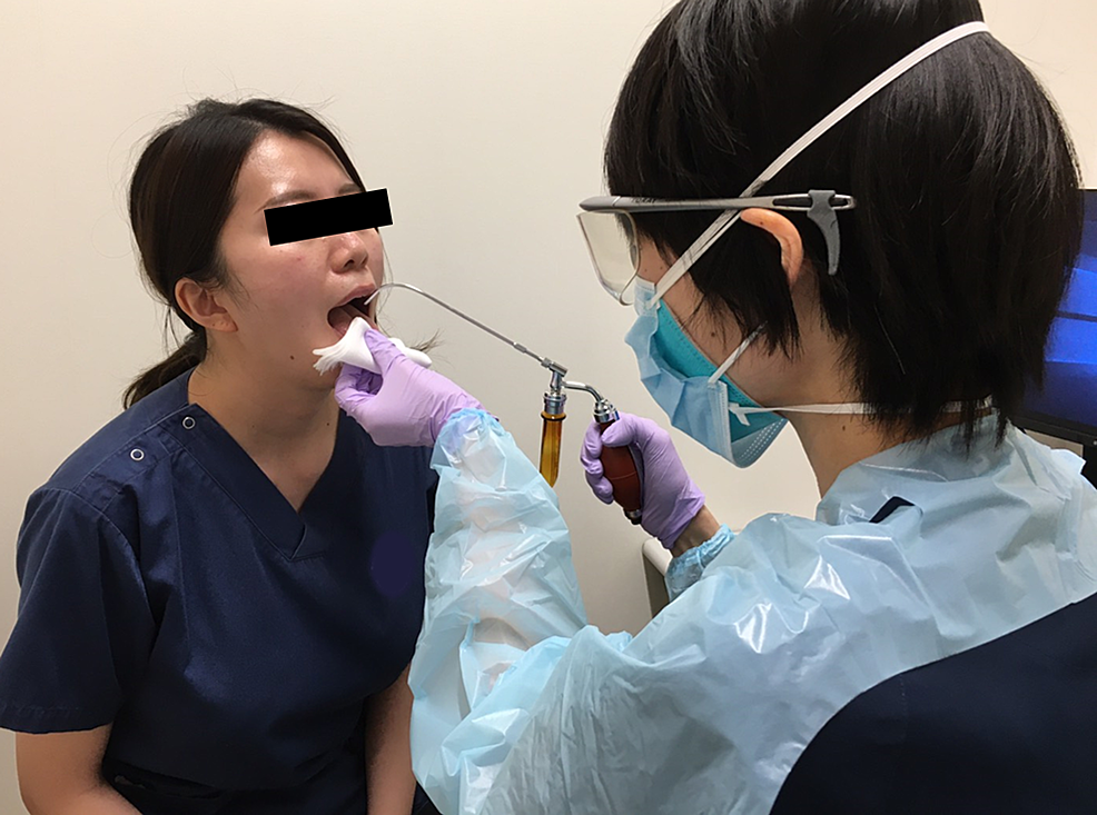 Cureus Omission of Throat Anesthesia Using Jackson’s Spray Prior to