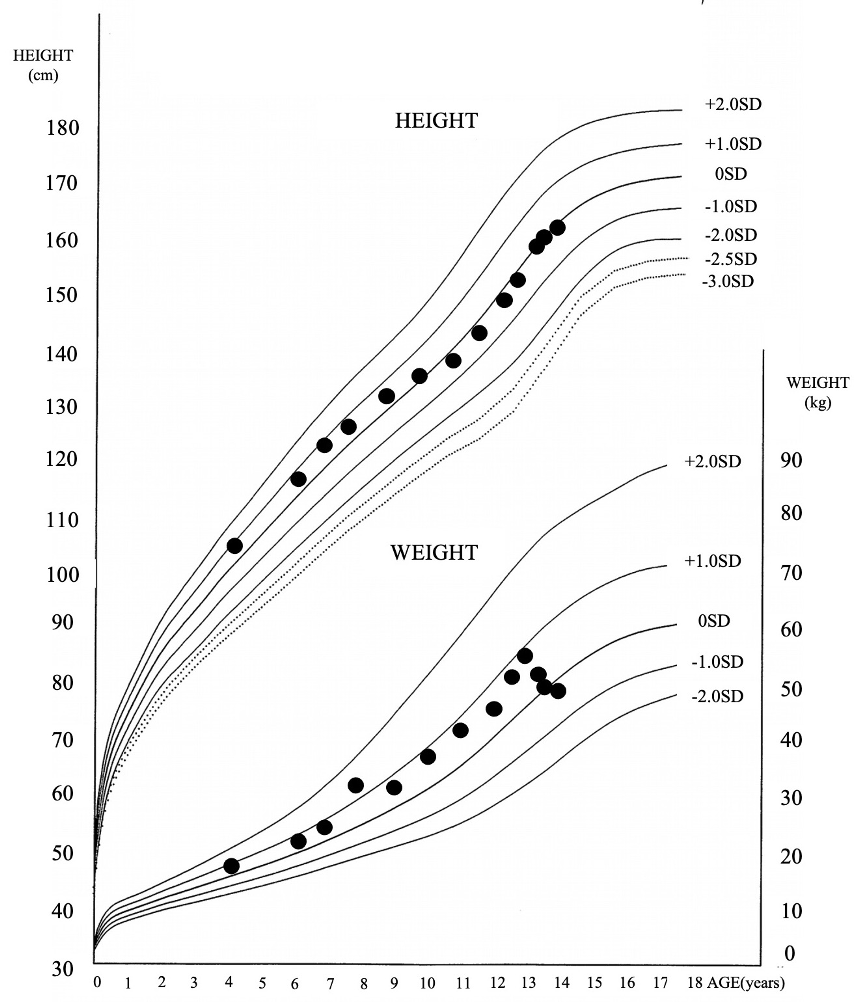 cureus-increased-serum-immunoglobulin-g4-levels-in-a-12-year-old-male