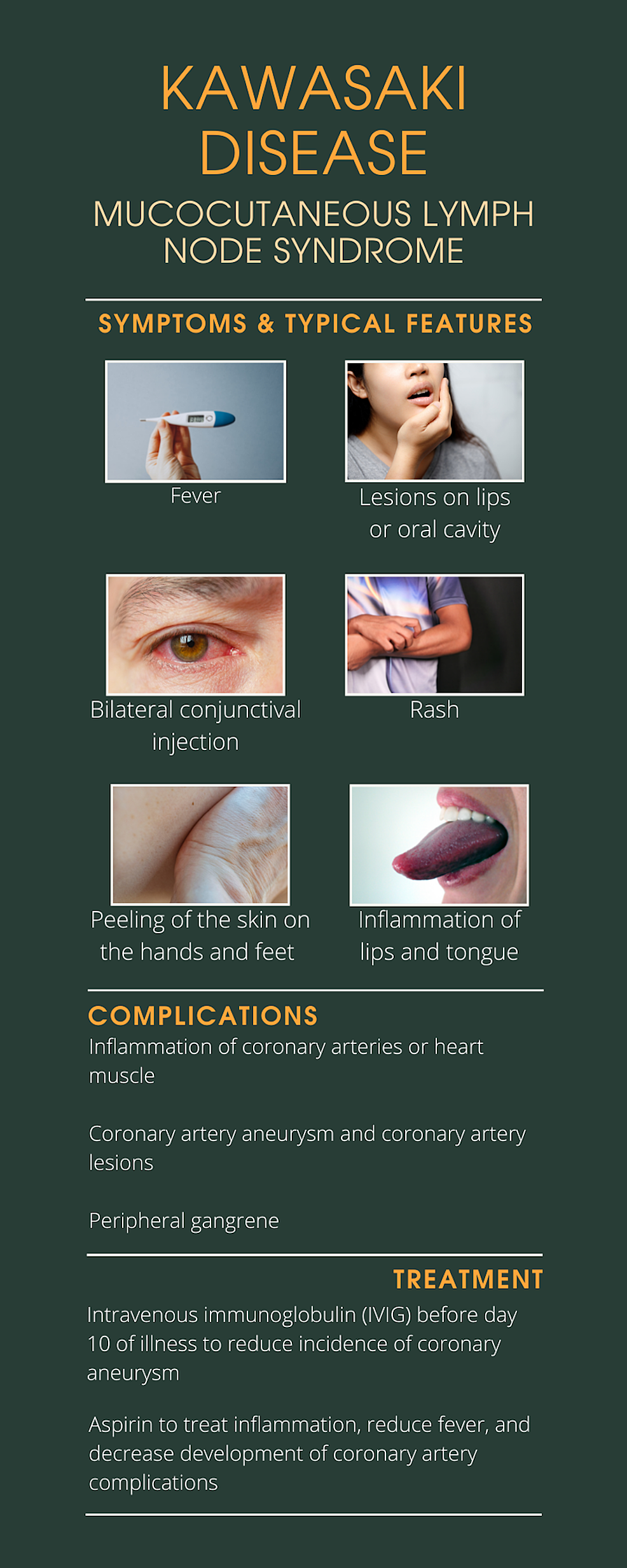 Abnormal Bedside Ultrasound Findings In A Complex Patient With Kawasaki ...