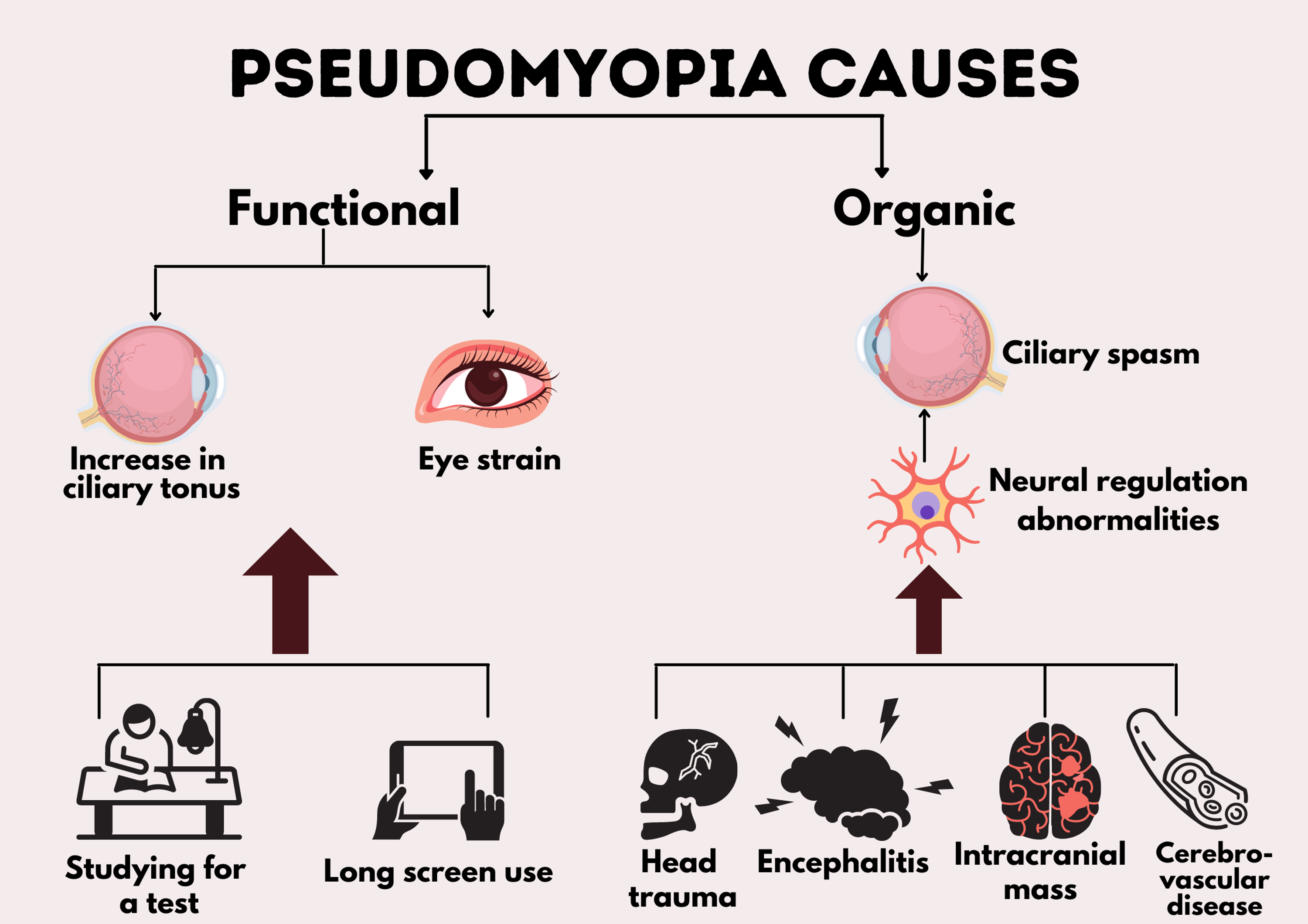 pseudomyopia glasses