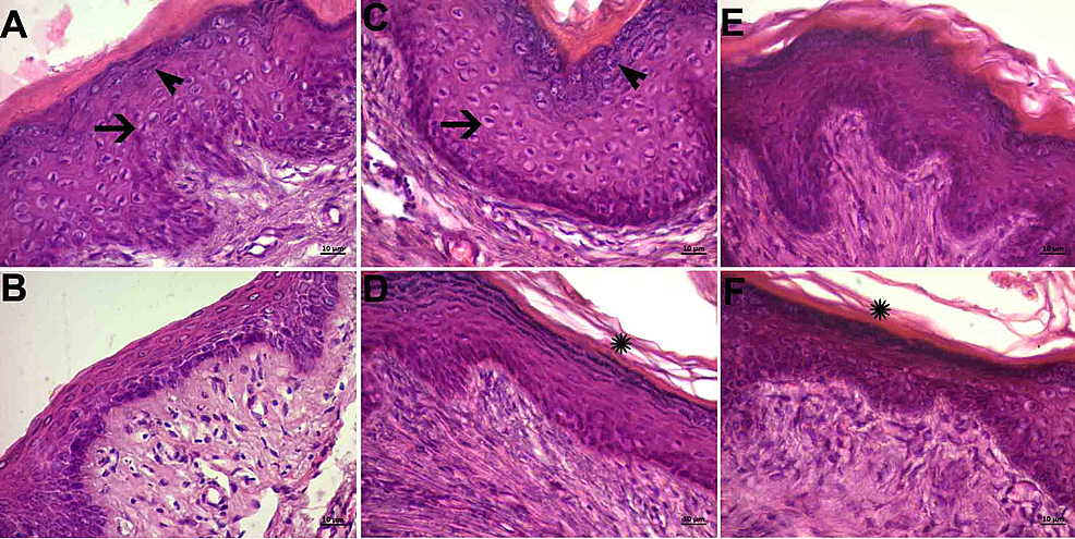 Histopathological Examination of the Mucosal Effects of Obstetric Gel ...