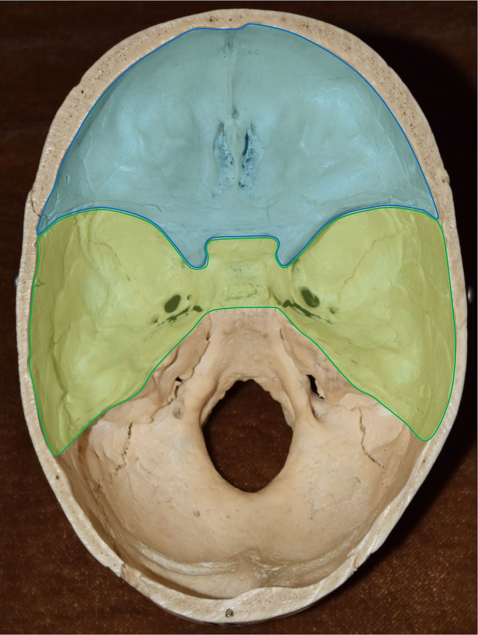 Cureus Cranial Nerve Foramina Part I A Review Of The Anatomy And Pathology Of Cranial Nerve 8004