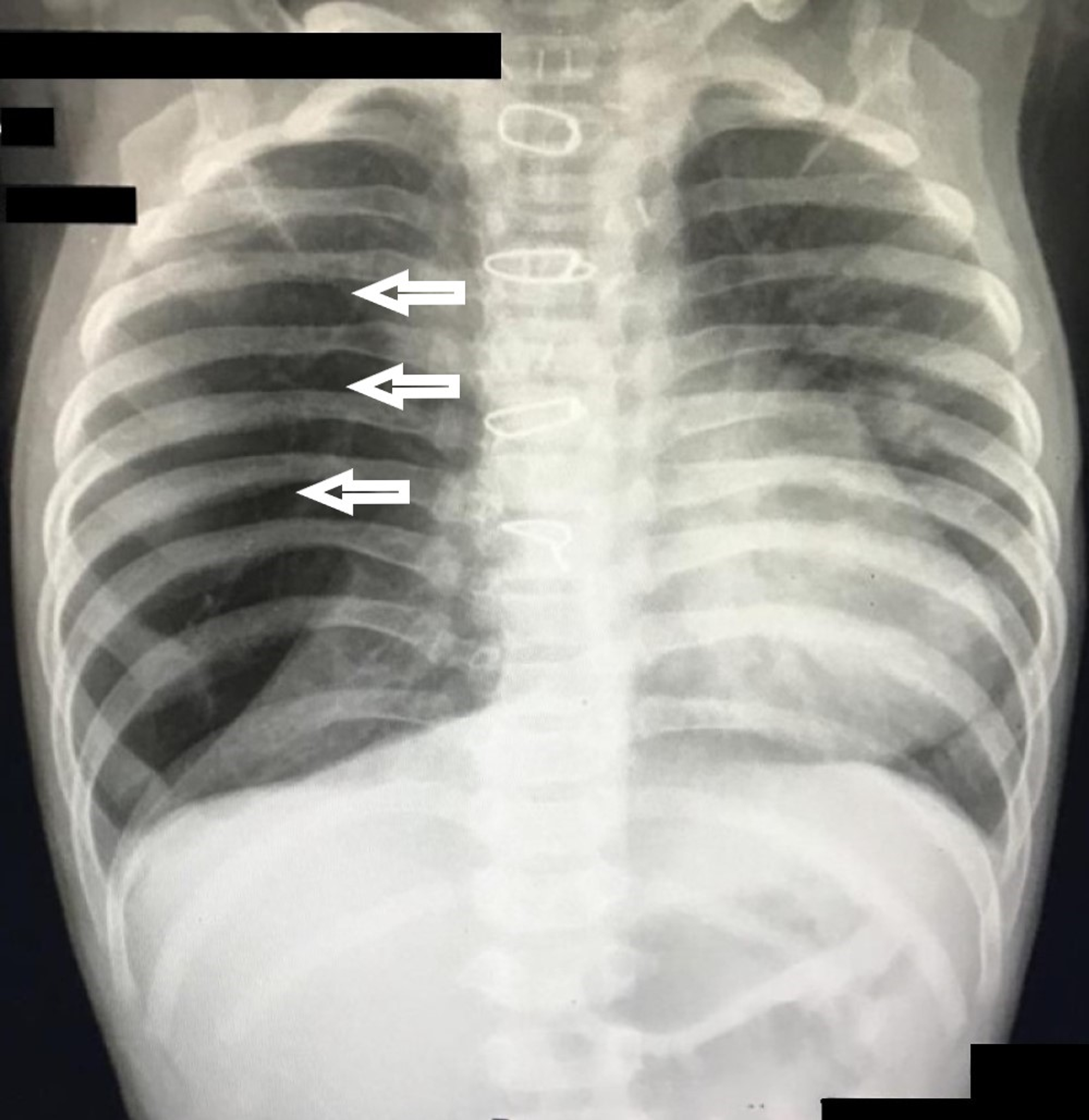 Cureus A Novel Approach to Facilitate an Ideal Surgical Correction of