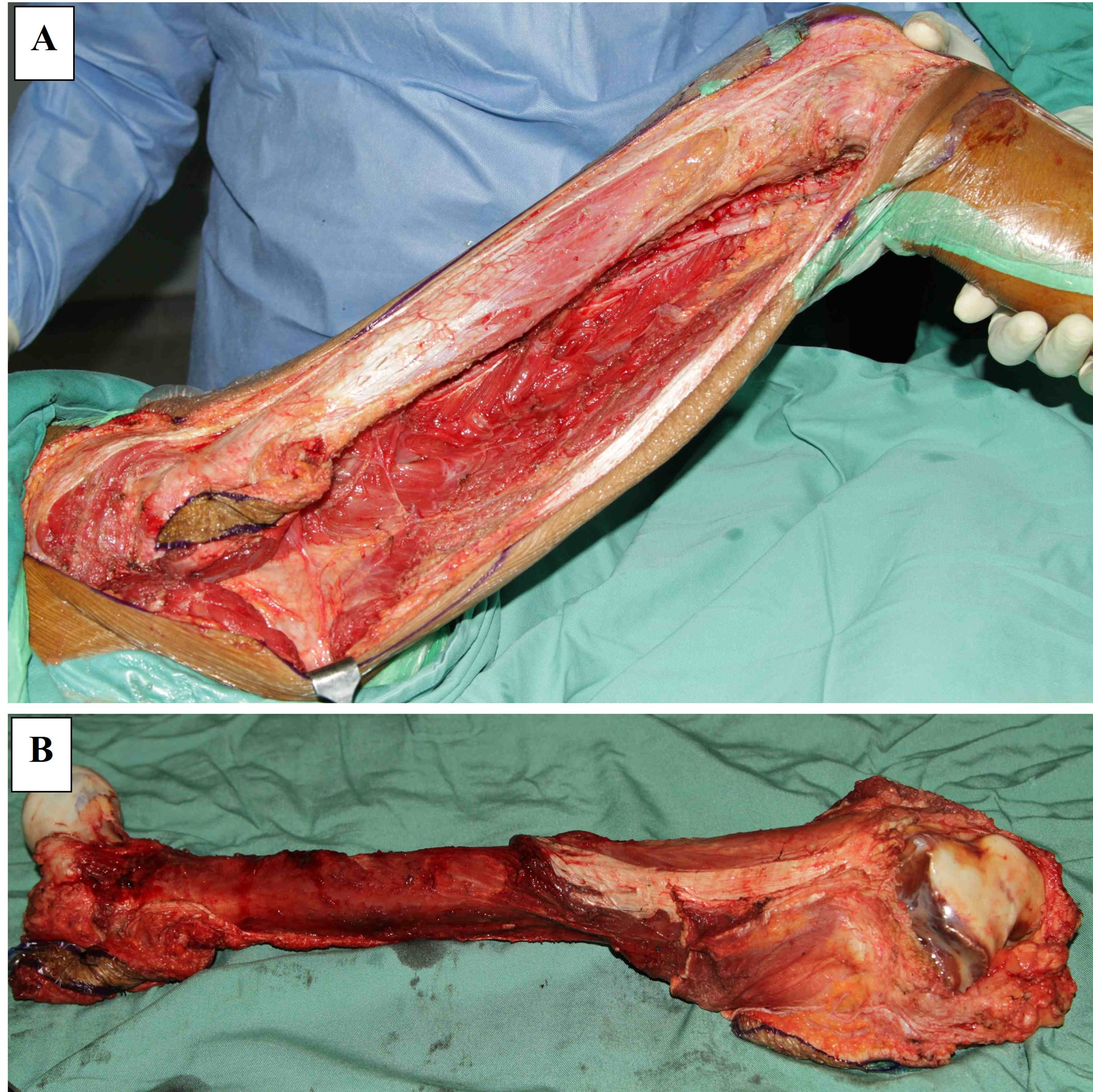 what are the first signs of osteosarcoma in dogs