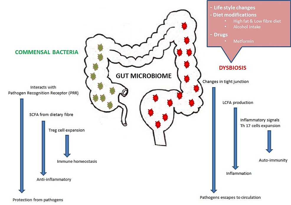 Cureus Is The Gut Microbiota A Neglected Aspect Of Gut And Brain