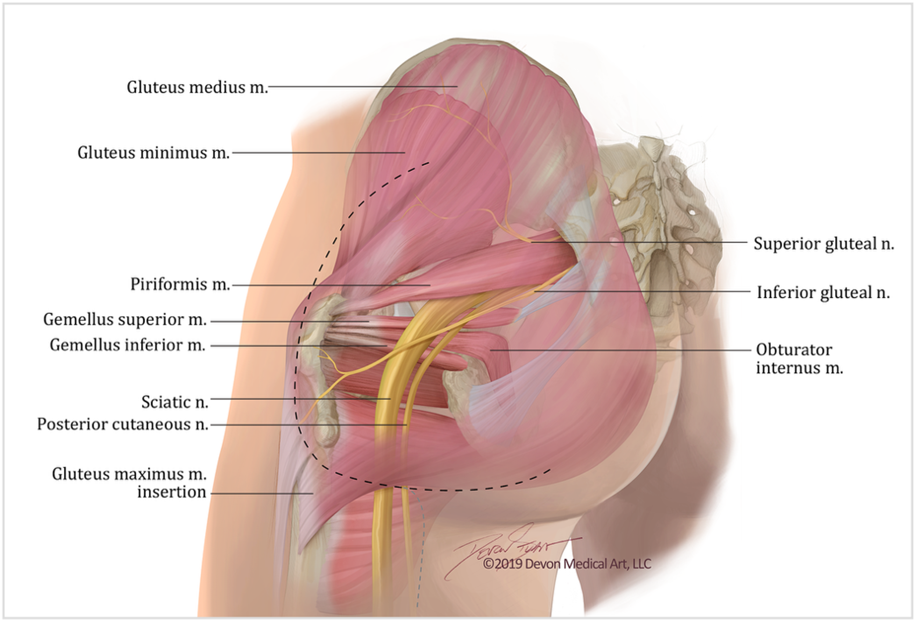 sciatic notch