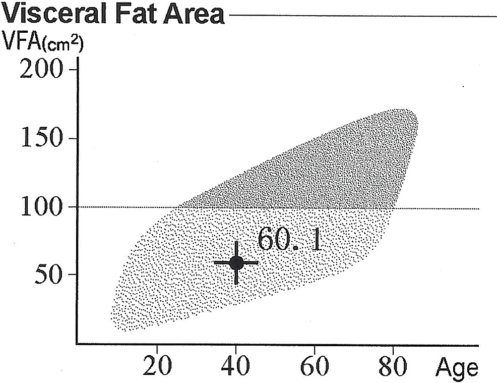 Visceral-fat-volumetric-assessment-after-weight-loss