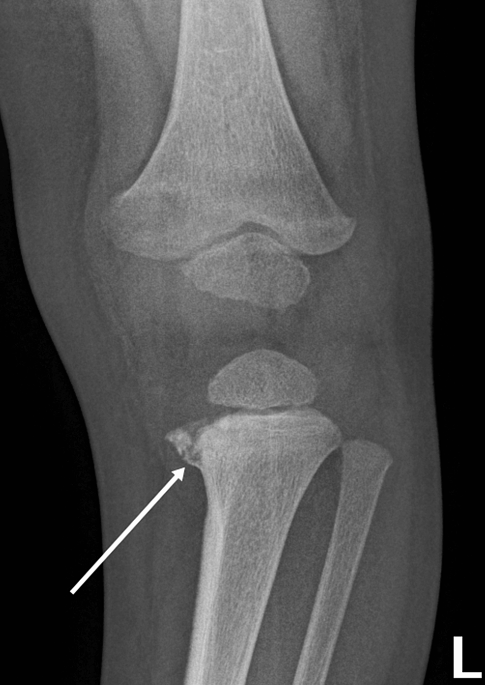 Cureus | A Multispecialty Approach to the Identification and Diagnosis ...