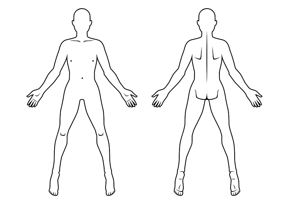 Cureus  Novel Software for Pain Drawing Analysis