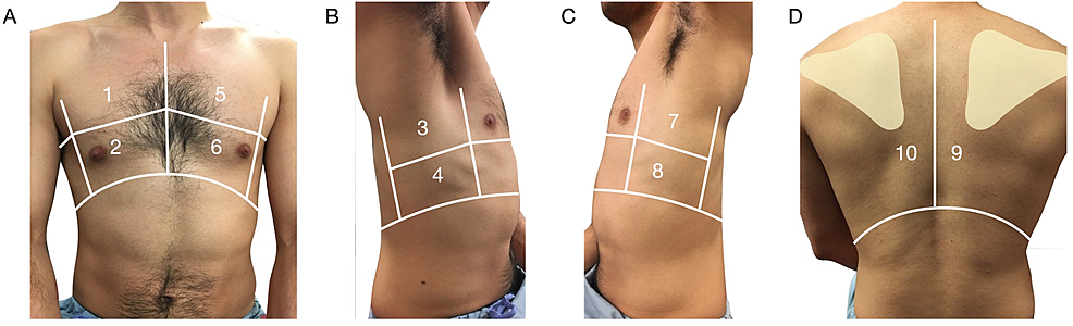 Ten-zone-lung-scanning-protocol.