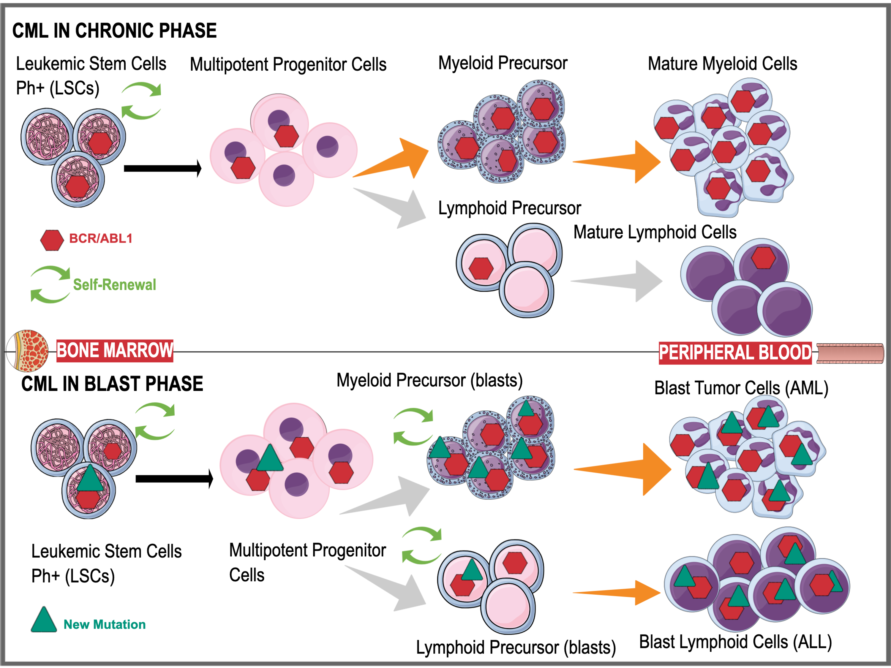 Cureus The Progression Of Chronic Myeloid Leukemia To Myeloid Sarcoma A Systematic Review