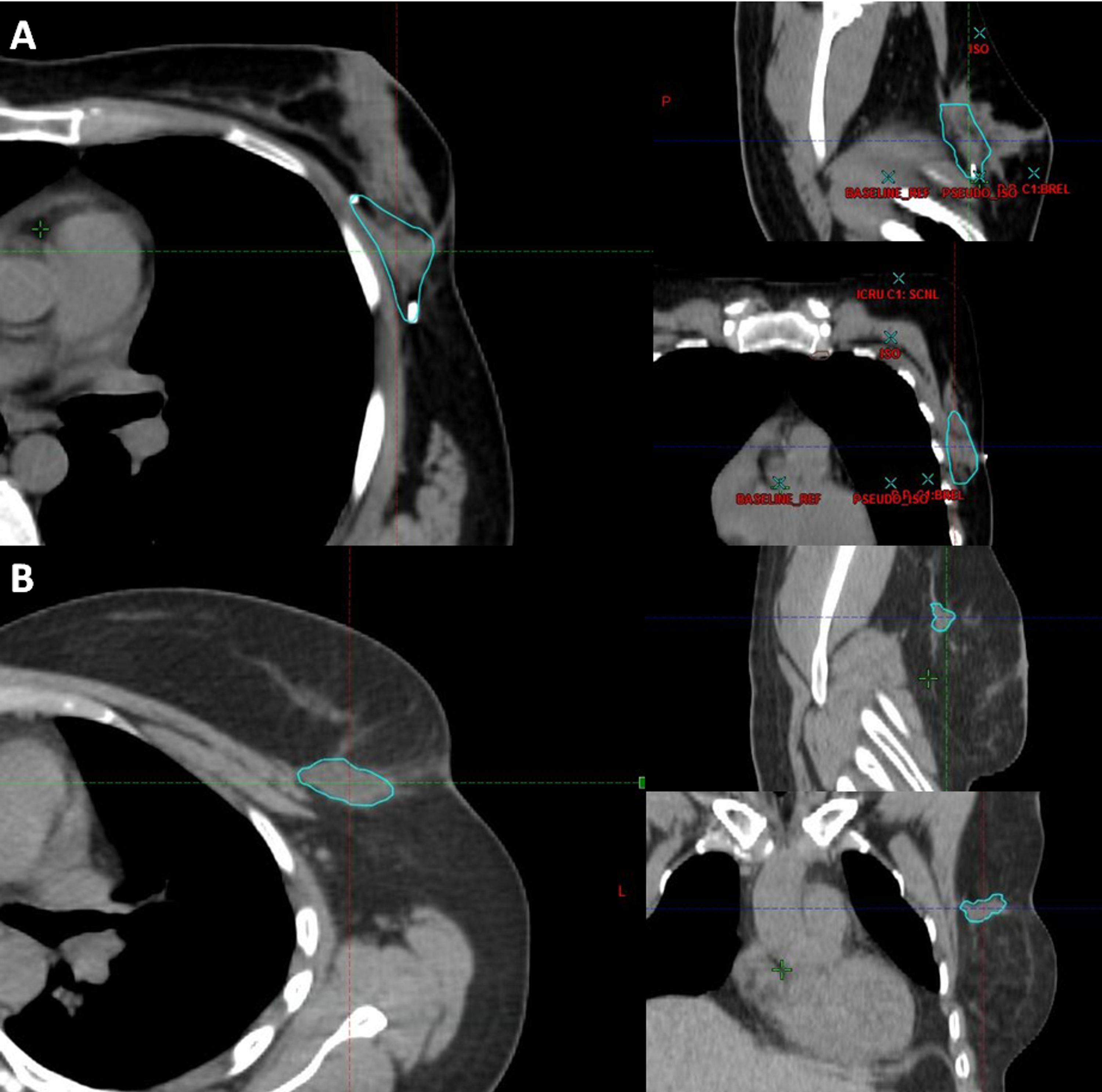 Atlas of Breast Surgical Techniques - burnet.com.ar