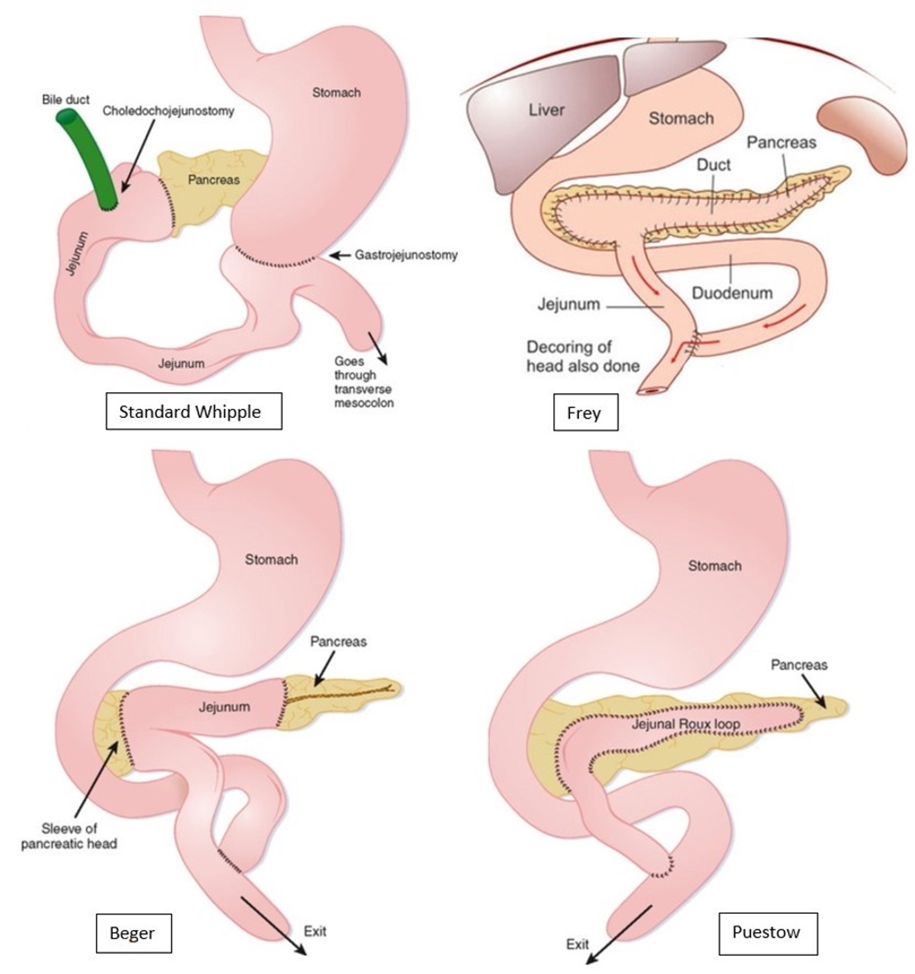 pancreas surface anatomy